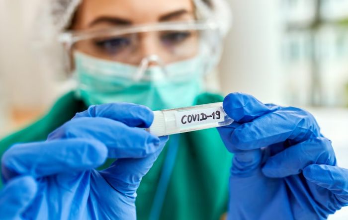 Заболеваемость ковидом в ХМАО выросла почти на треть за неделю