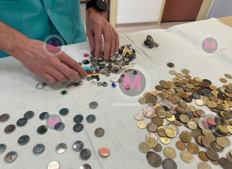 Нижневартовский врач показал коллекцию предметов, которые достал из детей