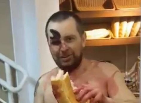 По улицам Нижневартовска ходил голый мужчина с ножом в глазу