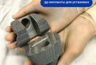 Сургутские врачи восстановили коленный сустав пациентки с помощью 3D-имплантов